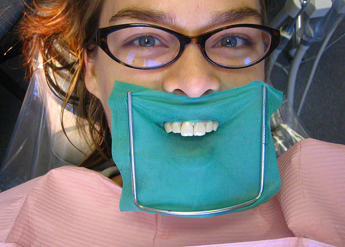 Patient with Dental Dam