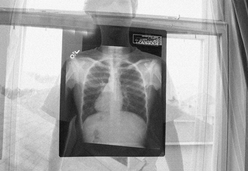 X-ray hanging in window